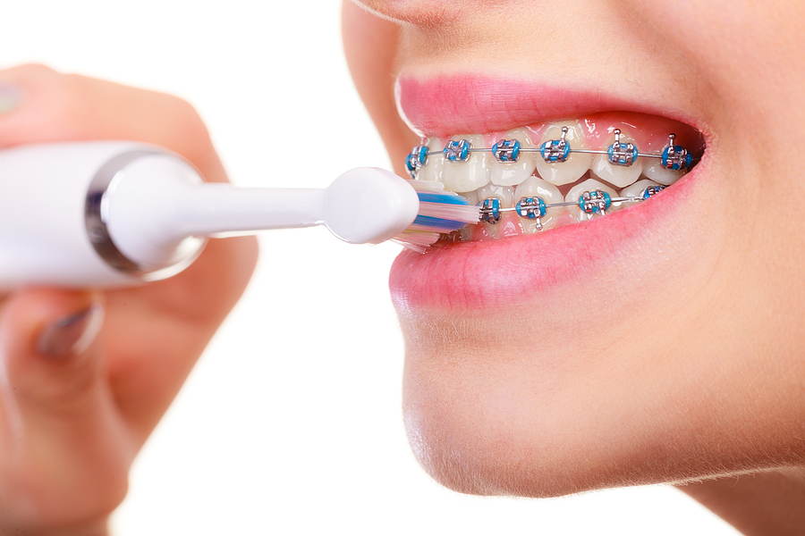 It’s Never Too Late: The Best Adult Orthodontic Treatments for a Confident Smile