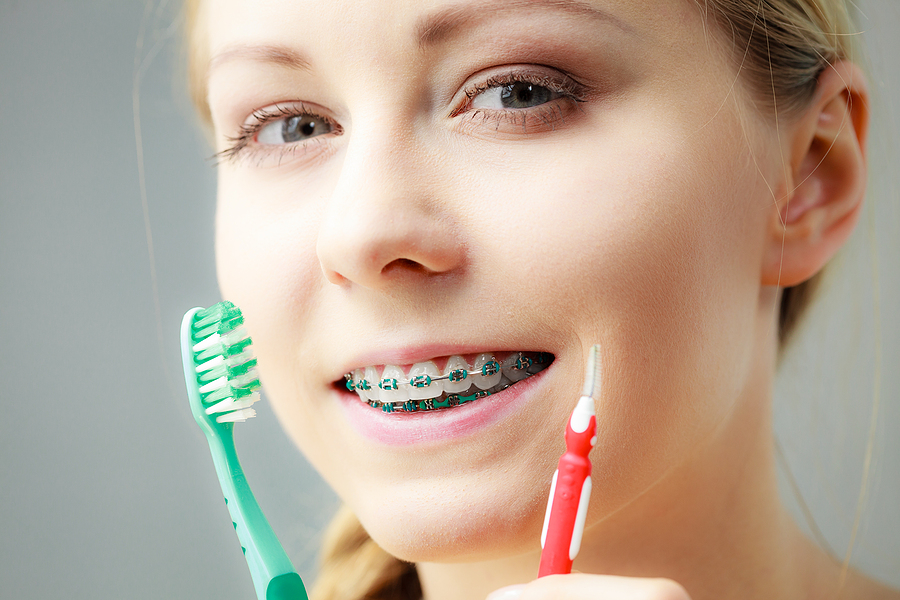 How Long Do You Need to Wear a Retainer After Braces?